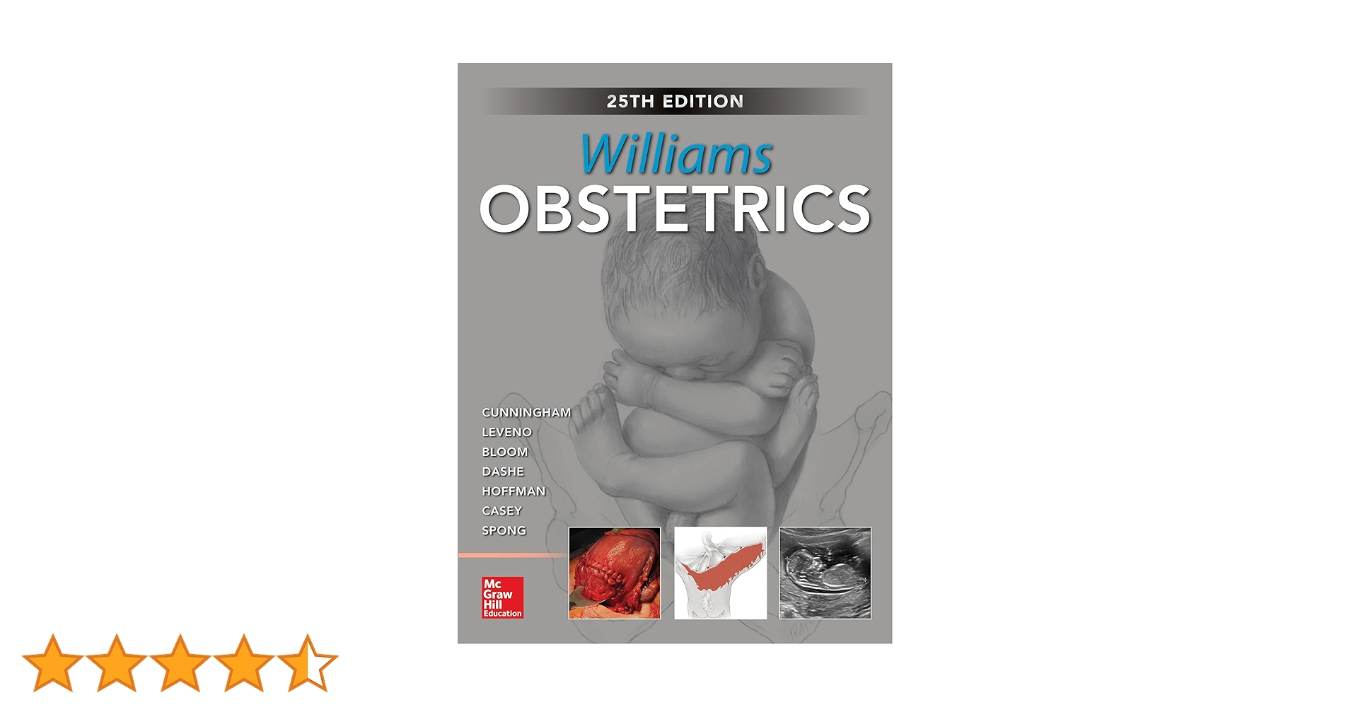 Williams Obstetrics 24/E Cunningham， F. Gary、 Leveno， Kenneth J.、 Bloom， Steven L.、 Spong， Catherine Y.; Dashe， Jodi S. Williams Obstetrics, 25th Edition - Kindle edition by Dashe